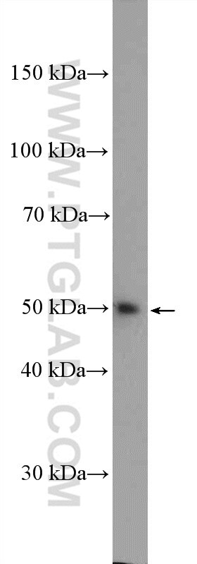 Western Blot (WB) analysis of HepG2 cells using LSM11 Polyclonal antibody (26119-1-AP)