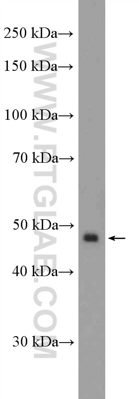 Western Blot (WB) analysis of HeLa cells using LSM11 Polyclonal antibody (26119-1-AP)