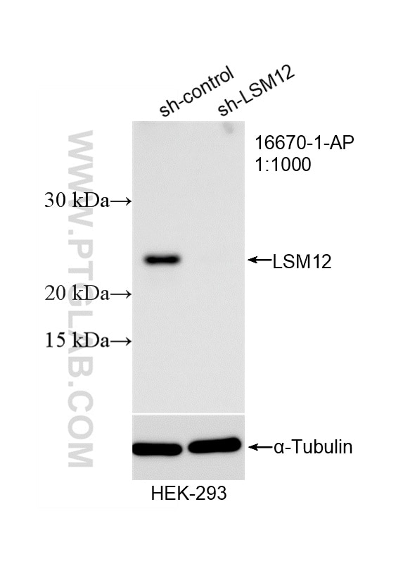 WB analysis of HEK-293 using 16670-1-AP Western Blot (WB) analysis of HEK-293 cells using LSM12 Polyclonal antibody (16670-1-AP)