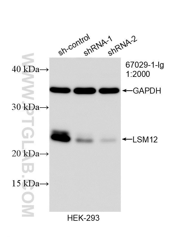 WB analysis of HEK-293 using 67029-1-Ig Western Blot (WB) analysis of HEK-293 cells using LSM12 Monoclonal antibody (67029-1-Ig)