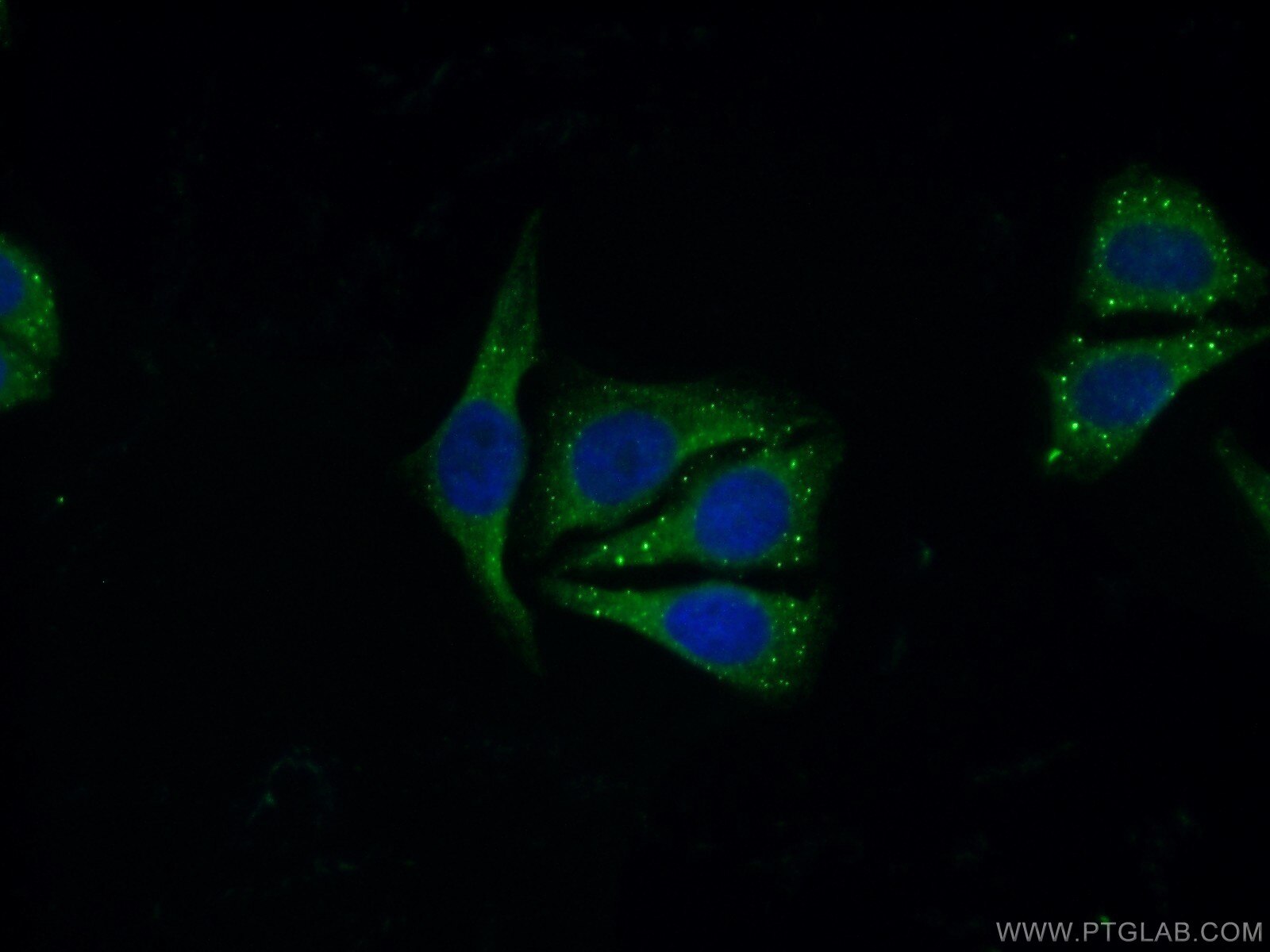 Immunofluorescence (IF) / fluorescent staining of HepG2 cells using LSM14A Polyclonal antibody (18336-1-AP)