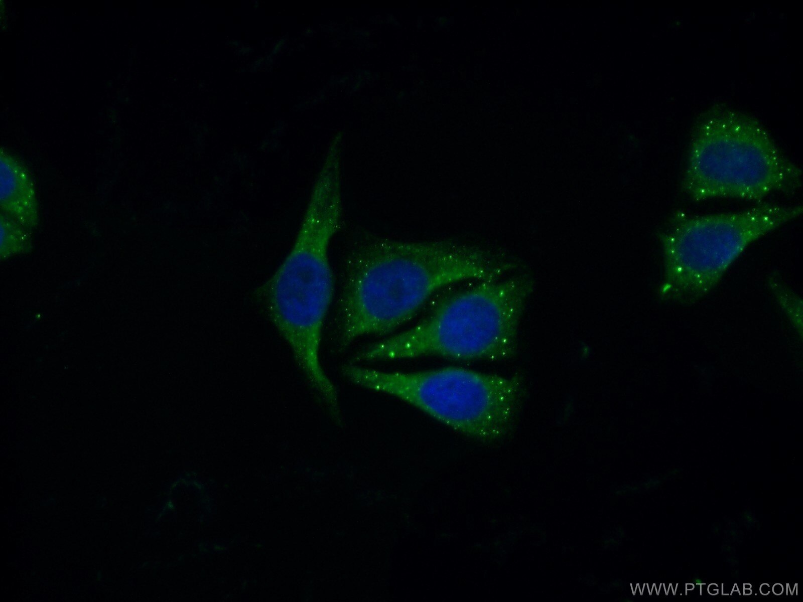 IF Staining of HepG2 using 18336-1-AP