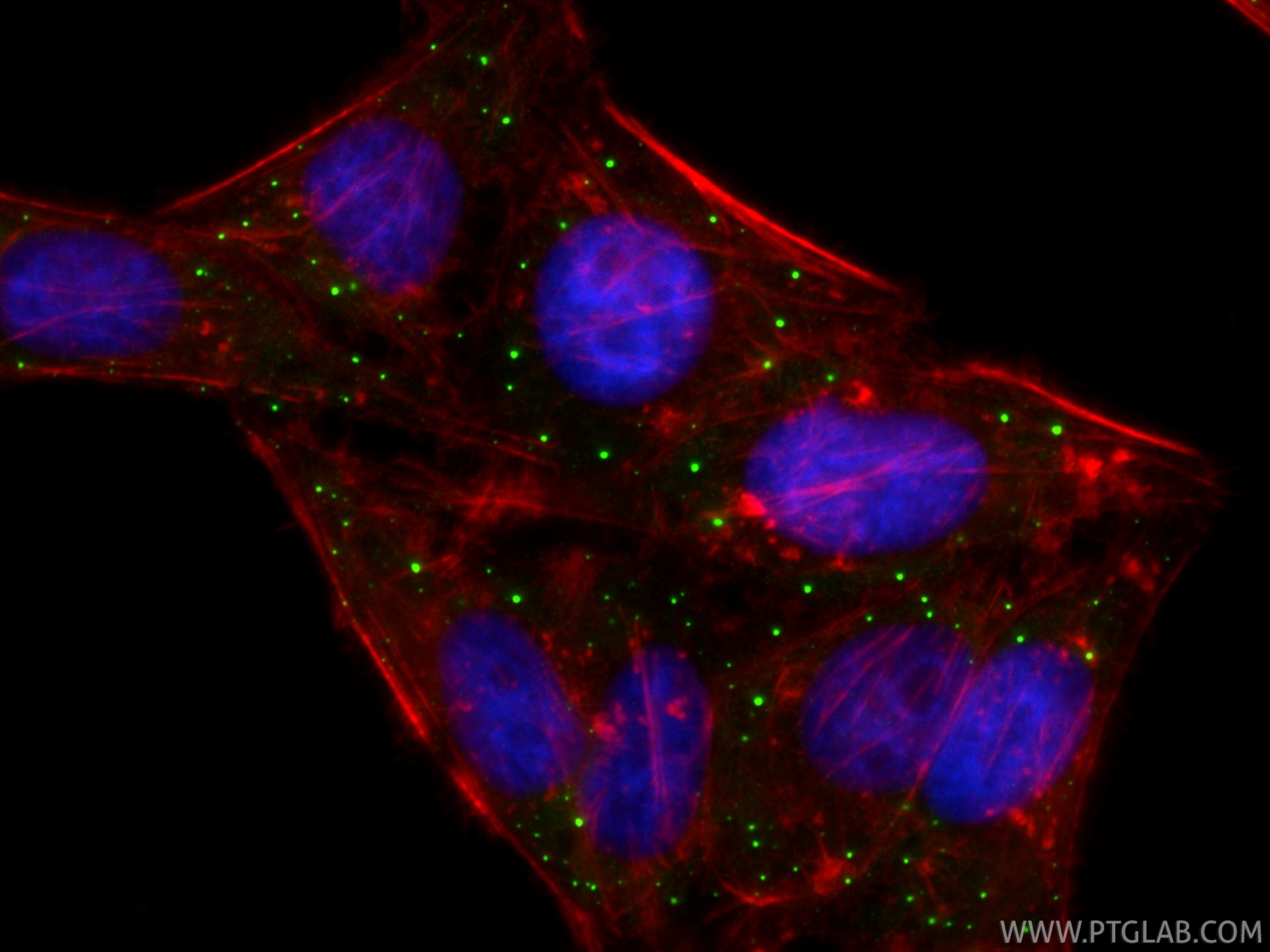 Immunofluorescence (IF) / fluorescent staining of HepG2 cells using LSM14A Polyclonal antibody (18336-1-AP)