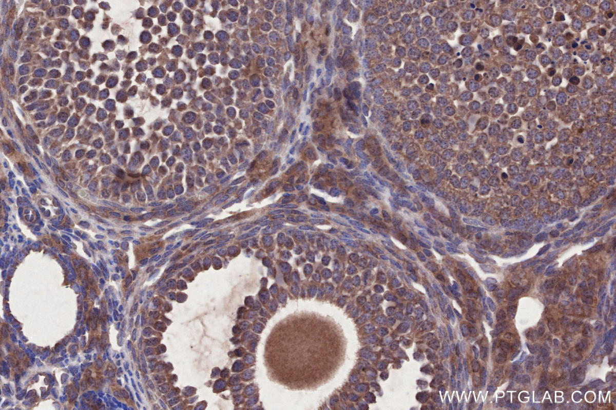 Immunohistochemistry (IHC) staining of mouse ovary tissue using LSM14A Polyclonal antibody (18336-1-AP)