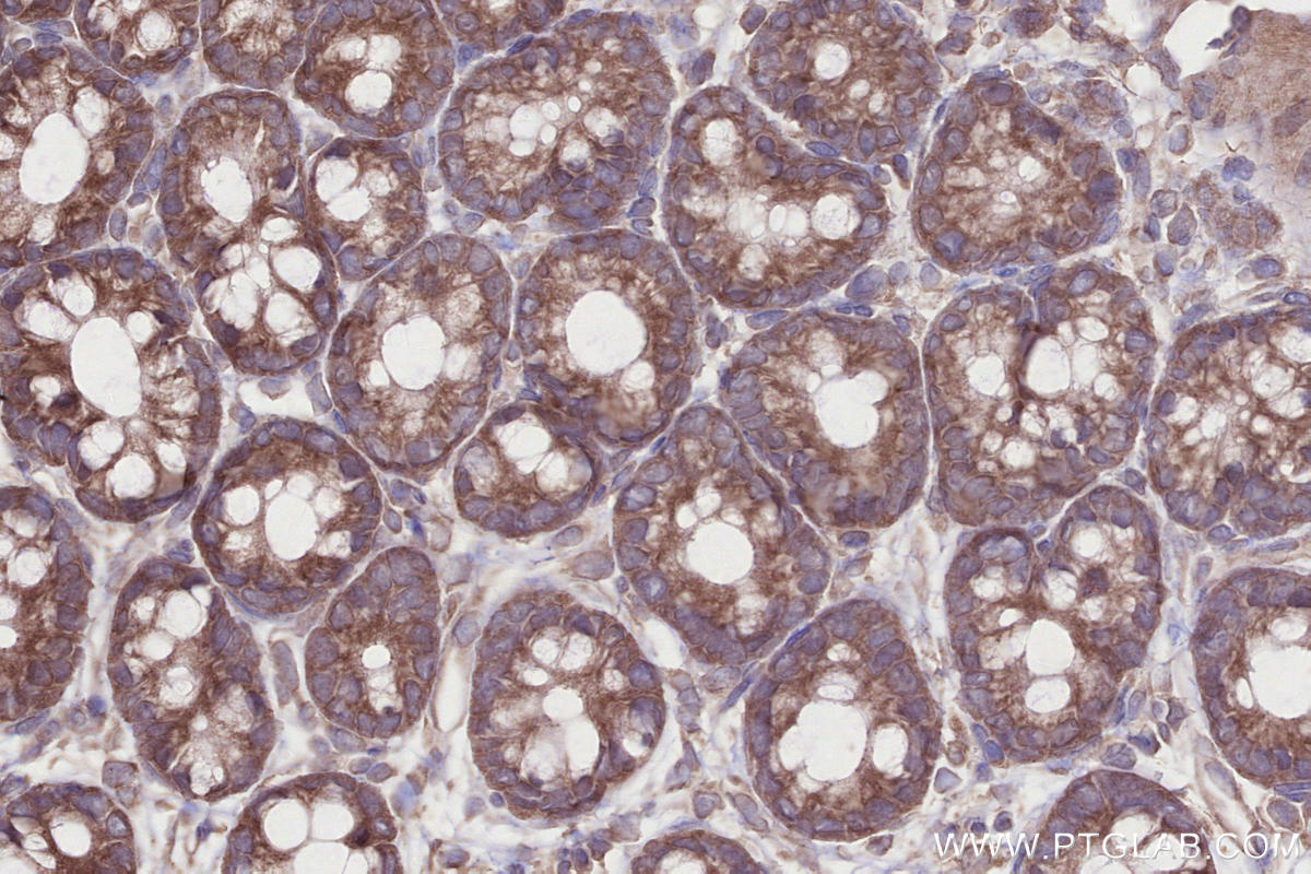 Immunohistochemistry (IHC) staining of rat colon tissue using LSM14A Polyclonal antibody (18336-1-AP)