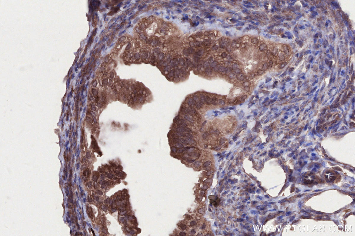 Immunohistochemistry (IHC) staining of mouse ovary tissue using LSM14A Polyclonal antibody (18336-1-AP)