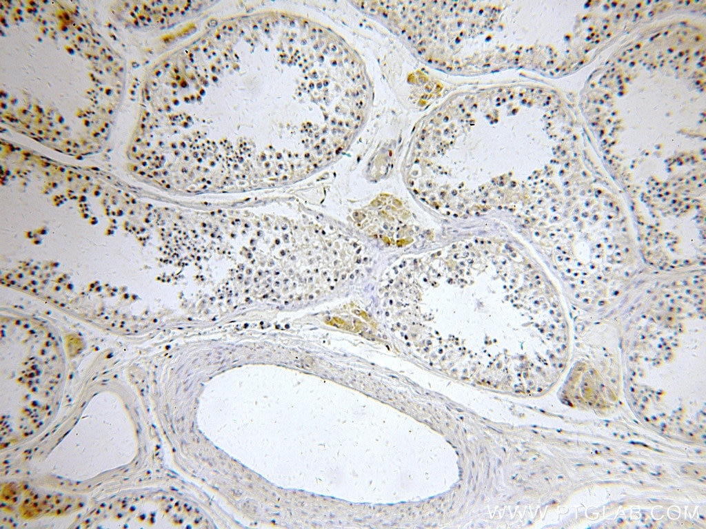 IHC staining of human testis using 18336-1-AP