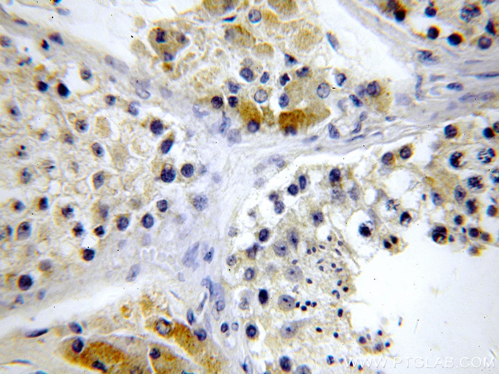 Immunohistochemistry (IHC) staining of human testis tissue using LSM14A Polyclonal antibody (18336-1-AP)