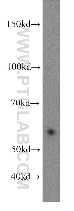 Western Blot (WB) analysis of HeLa cells using LSM14A Polyclonal antibody (18336-1-AP)