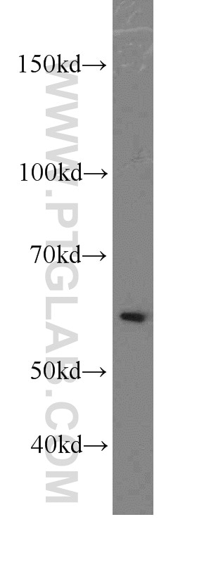 Western Blot (WB) analysis of A549 cells using LSM14A Polyclonal antibody (18336-1-AP)