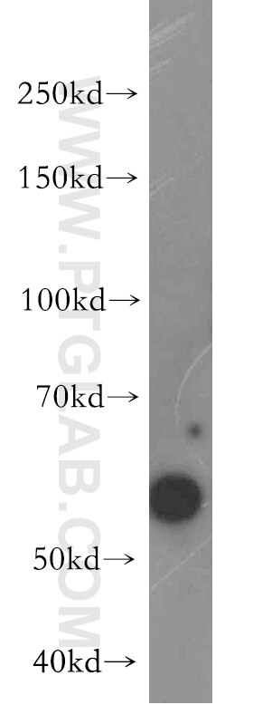 Western Blot (WB) analysis of PC-3 cells using LSM14A Polyclonal antibody (18336-1-AP)