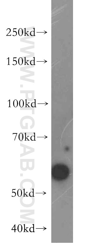 WB analysis of PC-3 using 18336-1-AP