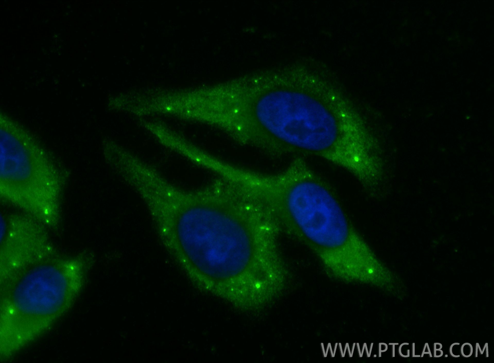 IF Staining of HepG2 using 33966-1-AP Immunofluorescence (IF) / fluorescent staining of HepG2 cells using LSM14A Polyclonal antibody (33966-1-AP)
