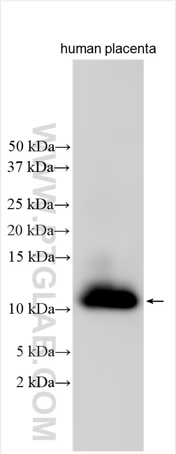 Western Blot (WB) analysis of various lysates using LSM2 Polyclonal antibody (10963-1-AP)
