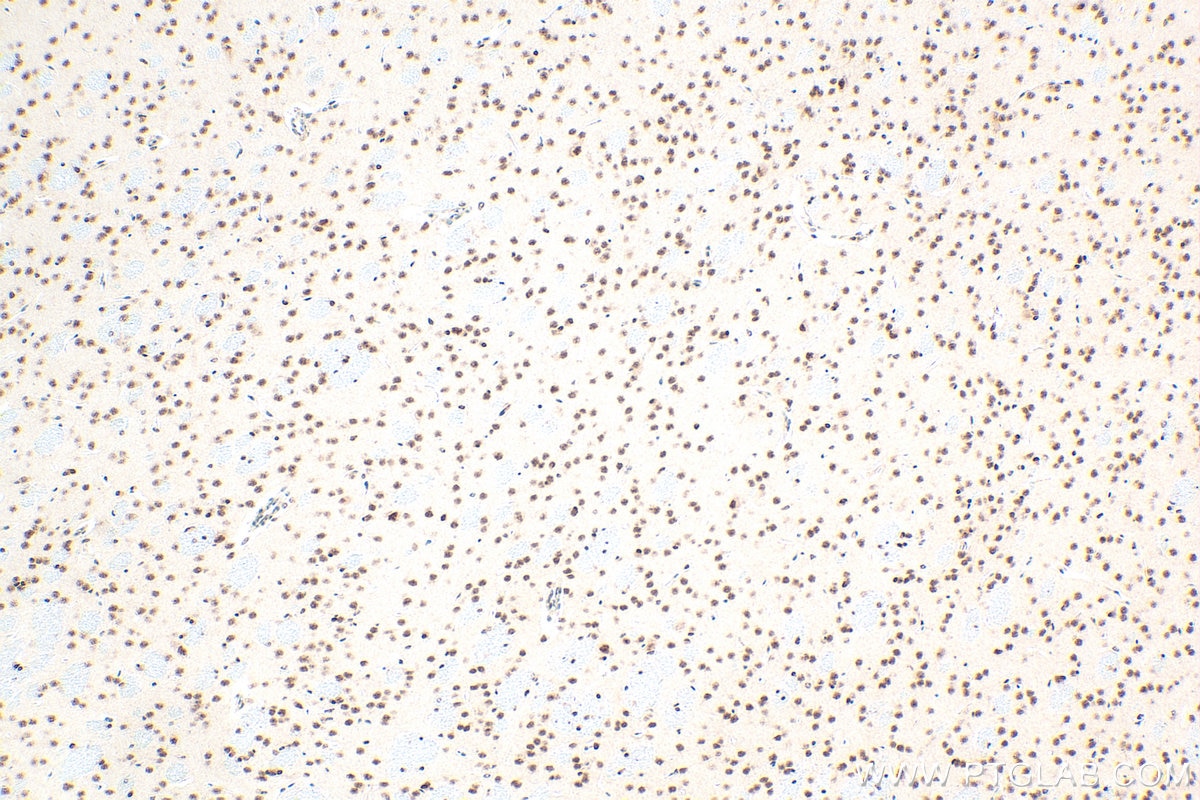 Immunohistochemistry (IHC) staining of mouse brain tissue using LSM2 Polyclonal antibody (32074-1-AP)