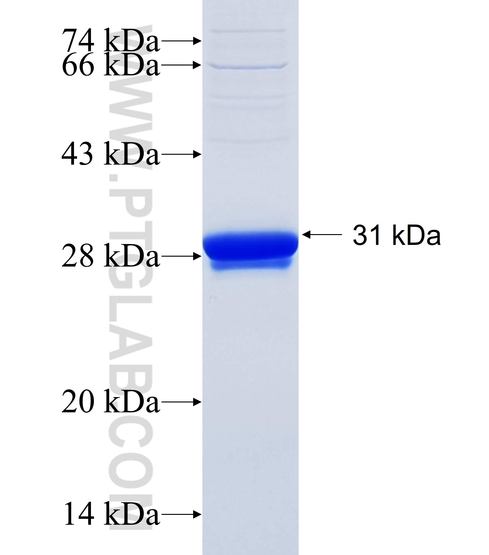 LSM2 fusion protein Ag34865 SDS-PAGE