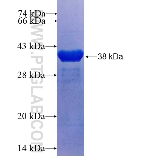 LSM3 fusion protein Ag8641 SDS-PAGE