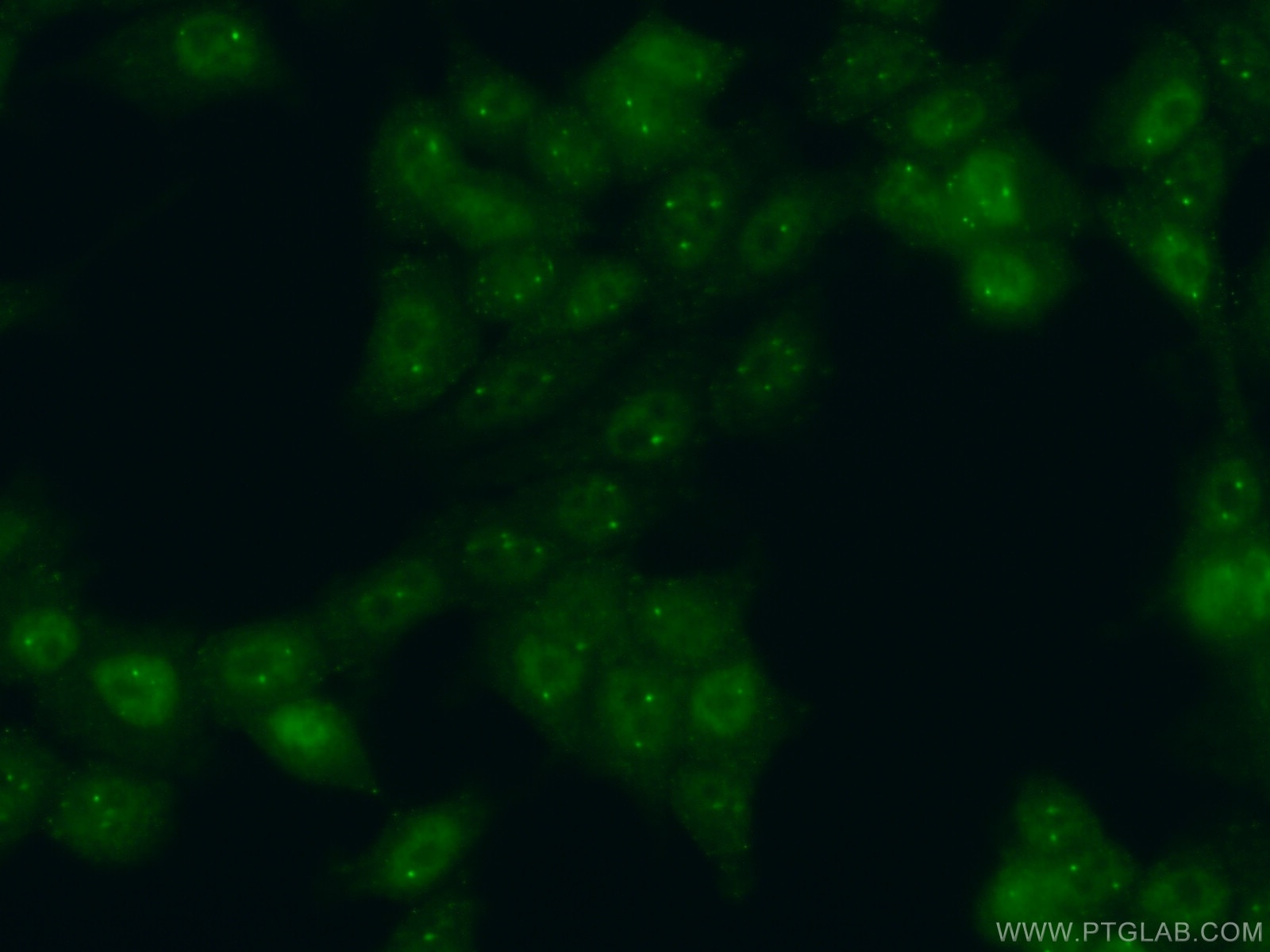 Immunofluorescence (IF) / fluorescent staining of MCF-7 cells using LSM4 Polyclonal antibody (10834-1-AP)