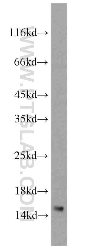 Western Blot (WB) analysis of MCF-7 cells using LSM4 Polyclonal antibody (10834-1-AP)