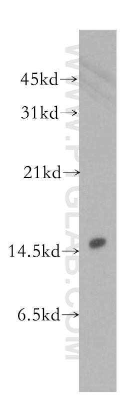 Western Blot (WB) analysis of human placenta tissue using LSM4 Polyclonal antibody (10834-1-AP)