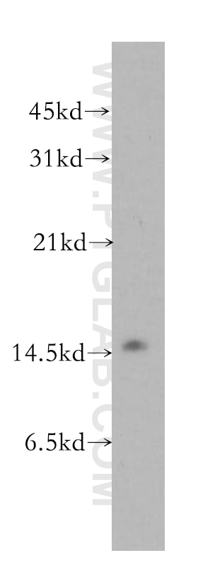 Western Blot (WB) analysis of MDA-MB-231 cells using LSM4 Polyclonal antibody (10834-1-AP)
