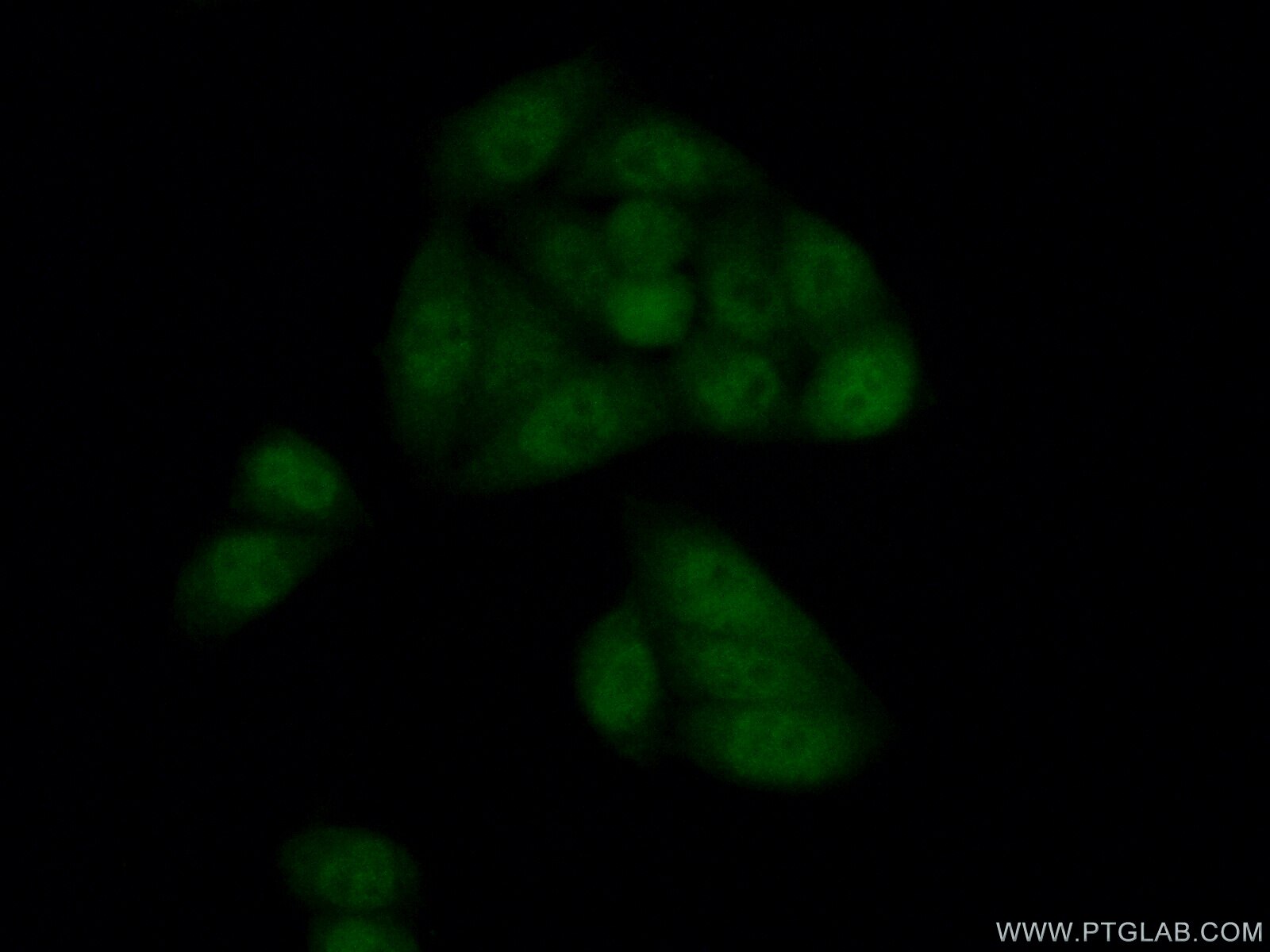 Immunofluorescence (IF) / fluorescent staining of HeLa cells using LSM5 Polyclonal antibody (10700-1-AP)