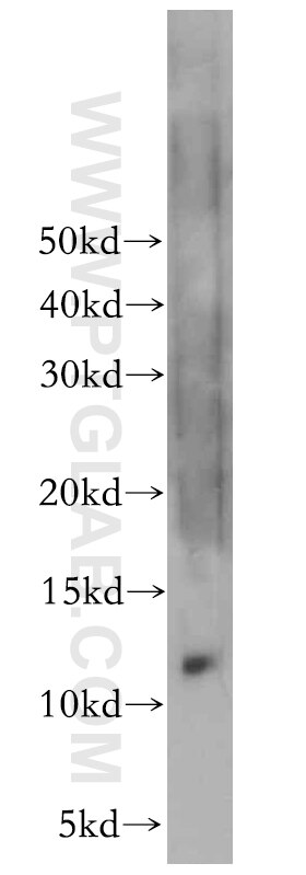 Western Blot (WB) analysis of human brain tissue using LSM5 Polyclonal antibody (10700-1-AP)