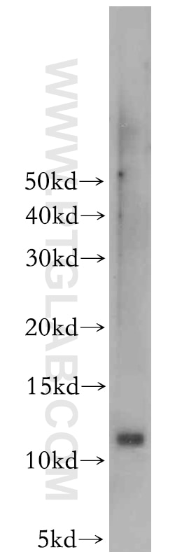 WB analysis of HL-60 using 10700-1-AP