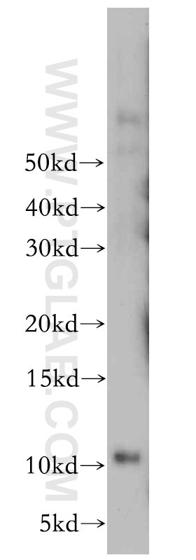 Western Blot (WB) analysis of human placenta tissue using LSM5 Polyclonal antibody (10700-1-AP)