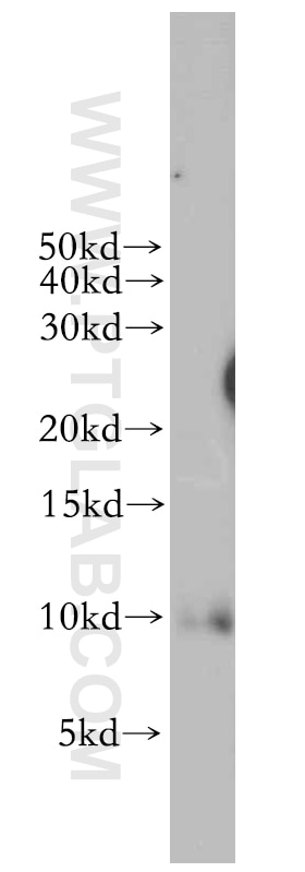 Western Blot (WB) analysis of mouse ovary tissue using LSM5 Polyclonal antibody (10700-1-AP)