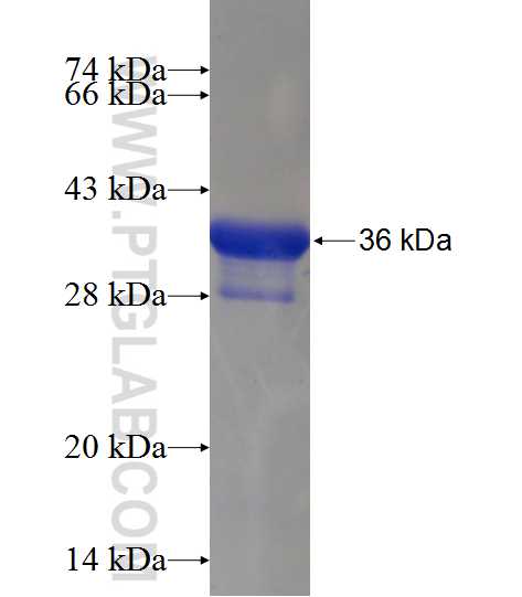LSM5 fusion protein Ag1145 SDS-PAGE