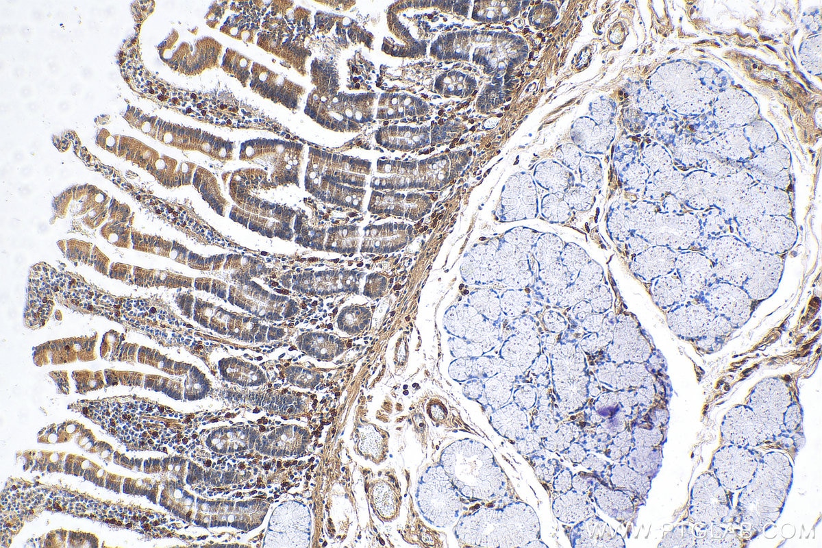 IHC staining of human stomach using 12138-1-AP