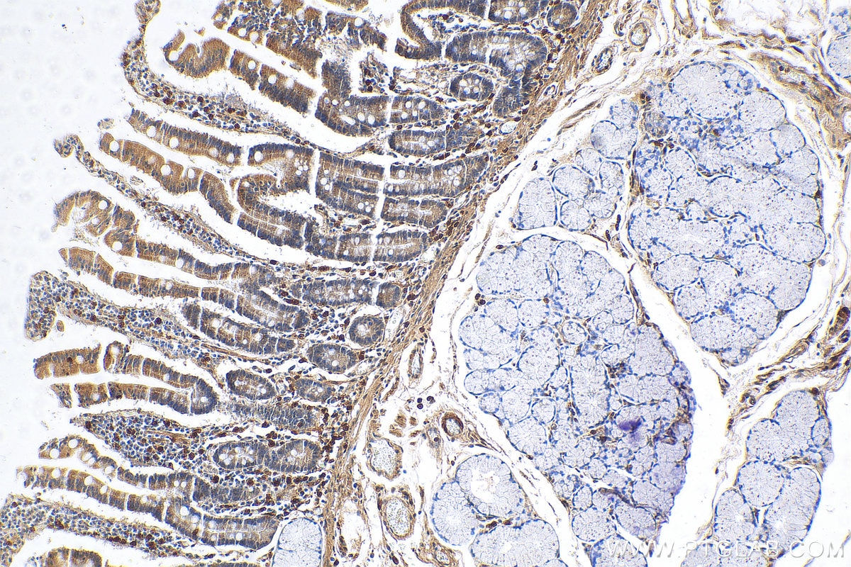 Immunohistochemistry (IHC) staining of human stomach tissue using LSM6 Polyclonal antibody (12138-1-AP)