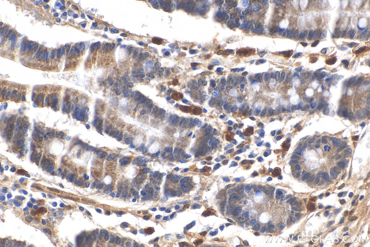 Immunohistochemistry (IHC) staining of human stomach tissue using LSM6 Polyclonal antibody (12138-1-AP)