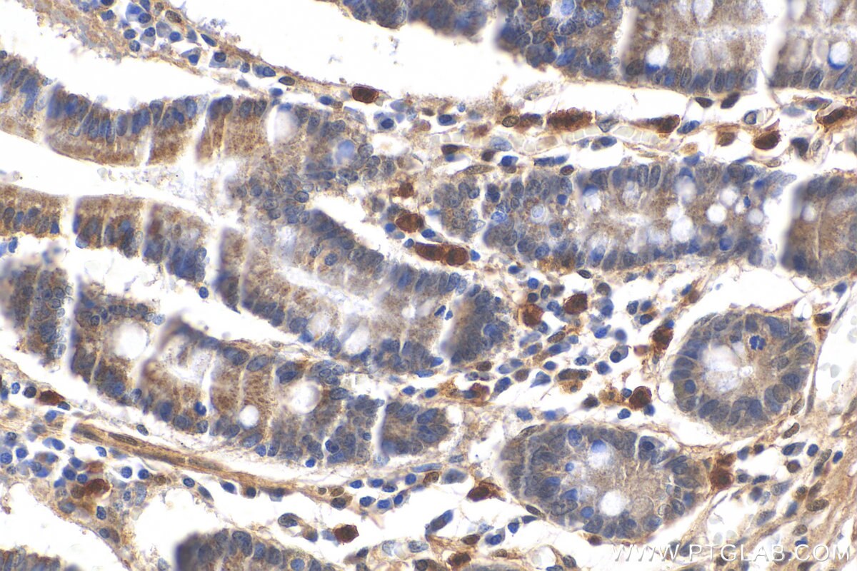 IHC staining of human stomach using 12138-1-AP