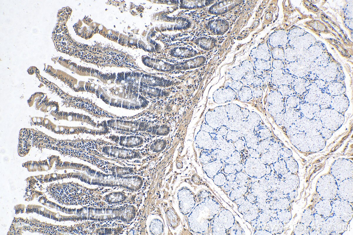 Immunohistochemistry (IHC) staining of human stomach tissue using LSM6 Polyclonal antibody (12138-1-AP)