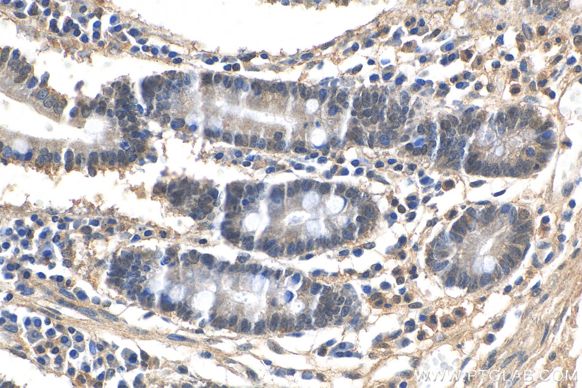 Immunohistochemistry (IHC) staining of human stomach tissue using LSM6 Polyclonal antibody (12138-1-AP)