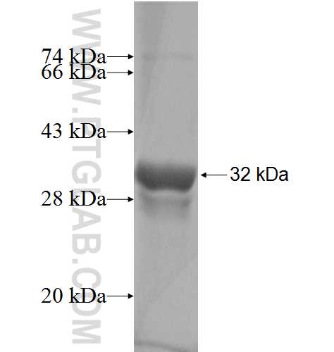 LSM6 fusion protein Ag2784 SDS-PAGE