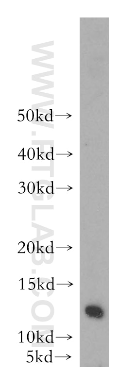 Western Blot (WB) analysis of HeLa cells using LSM7 Polyclonal antibody (18941-1-AP)