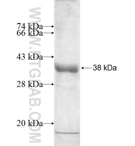 LSM7 fusion protein Ag2174 SDS-PAGE