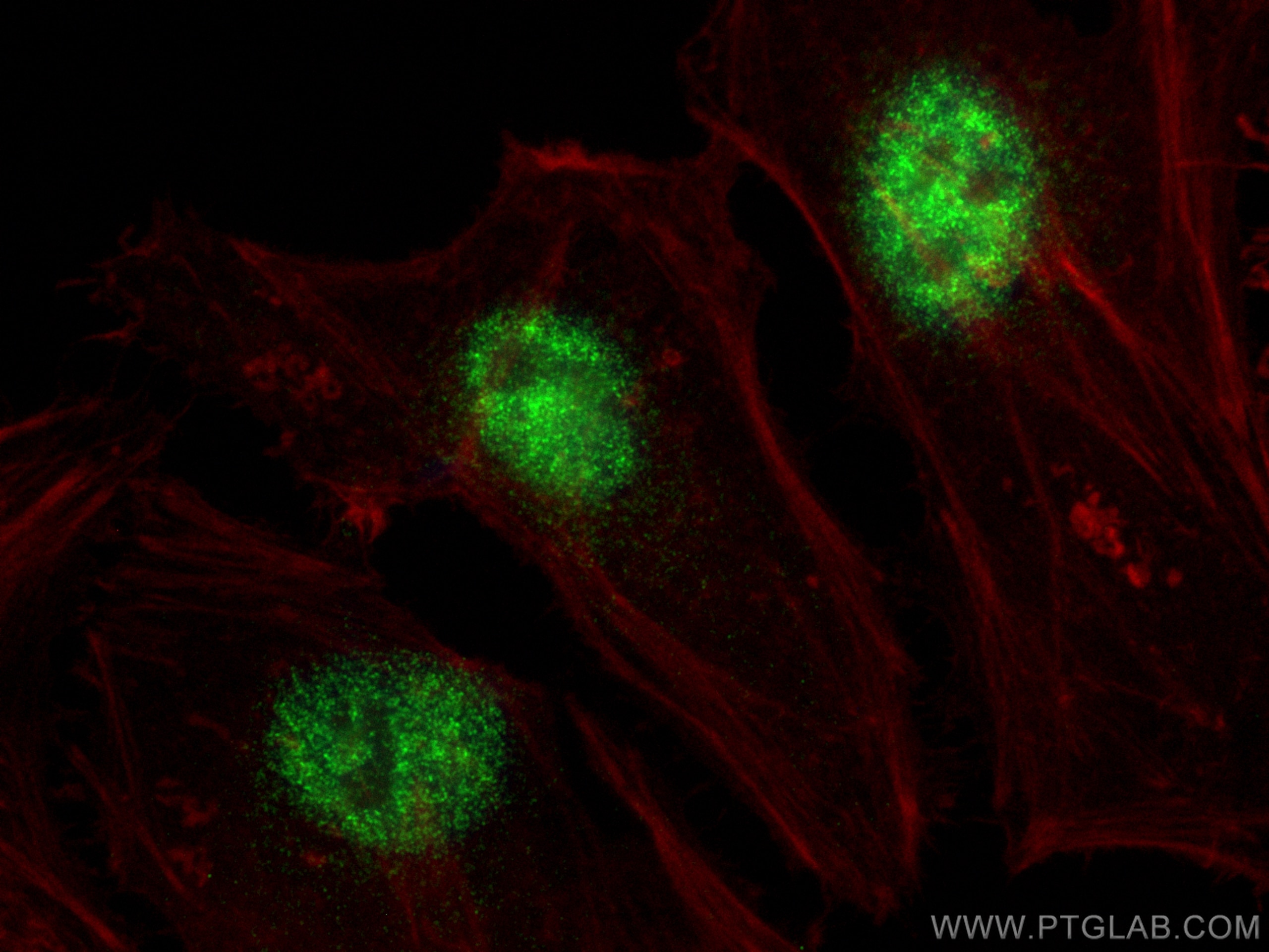 Immunofluorescence (IF) / fluorescent staining of HeLa cells using LSM8 Polyclonal antibody (10134-1-AP)