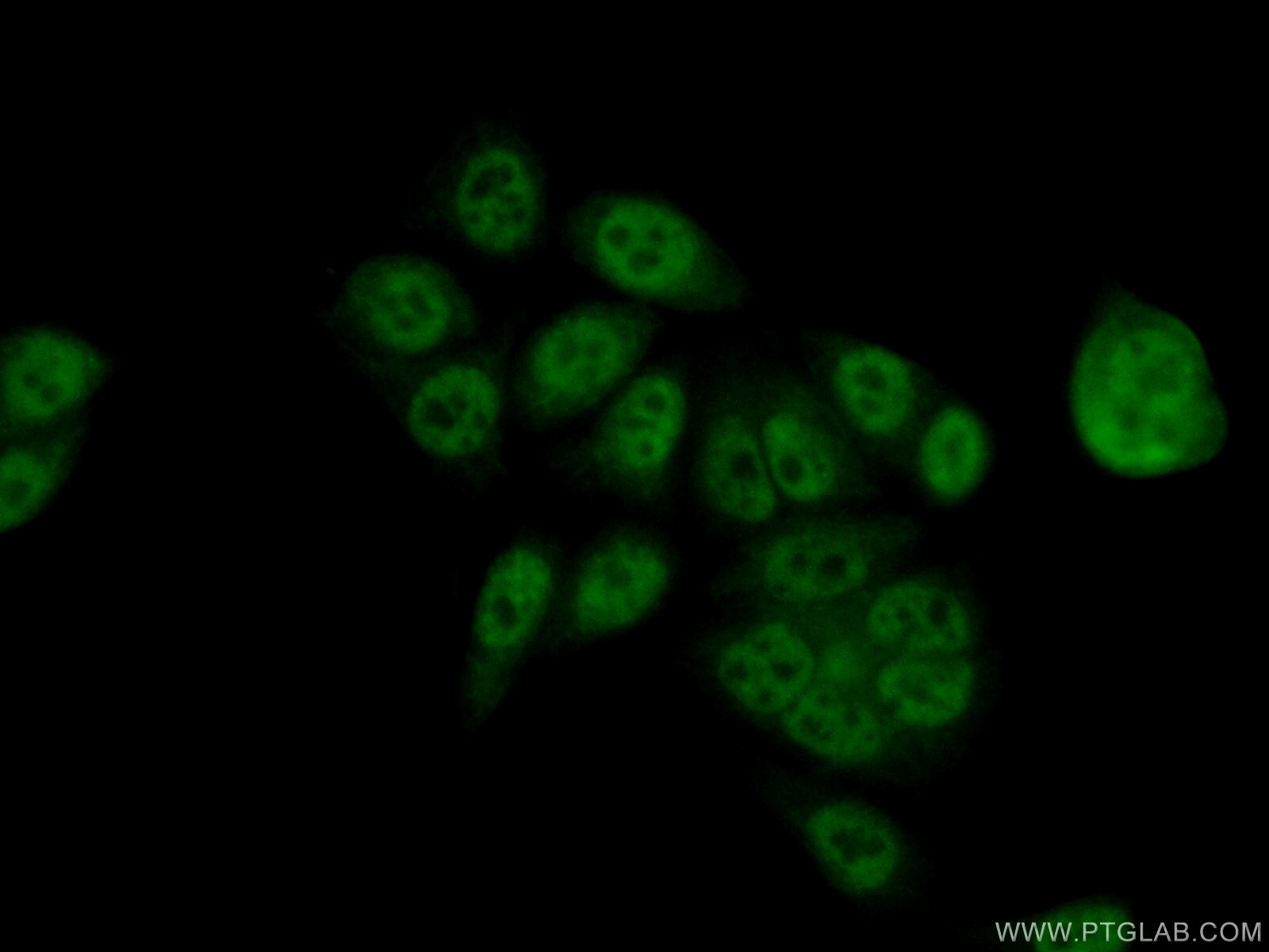 Immunofluorescence (IF) / fluorescent staining of HeLa cells using LSM8 Polyclonal antibody (10134-1-AP)
