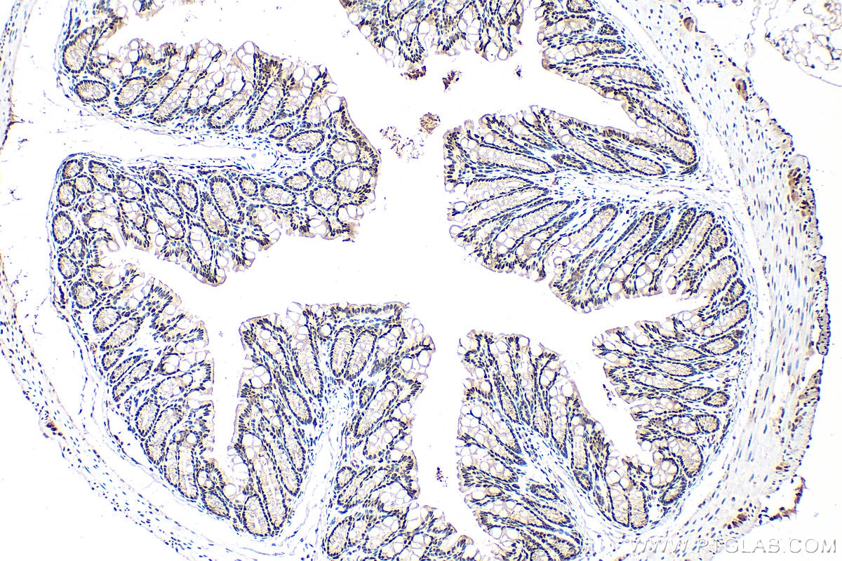 Immunohistochemistry (IHC) staining of mouse colon tissue using LSM8 Polyclonal antibody (10134-1-AP)