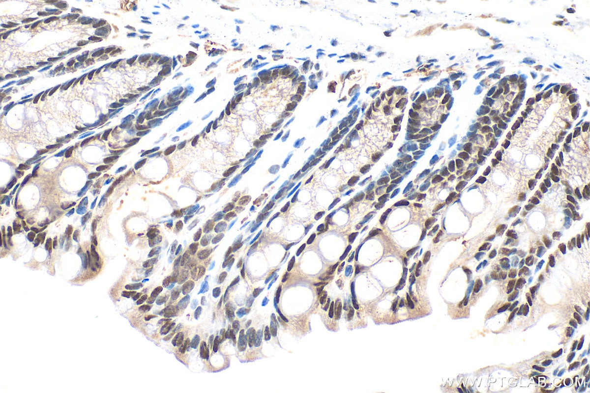 Immunohistochemistry (IHC) staining of mouse colon tissue using LSM8 Polyclonal antibody (10134-1-AP)