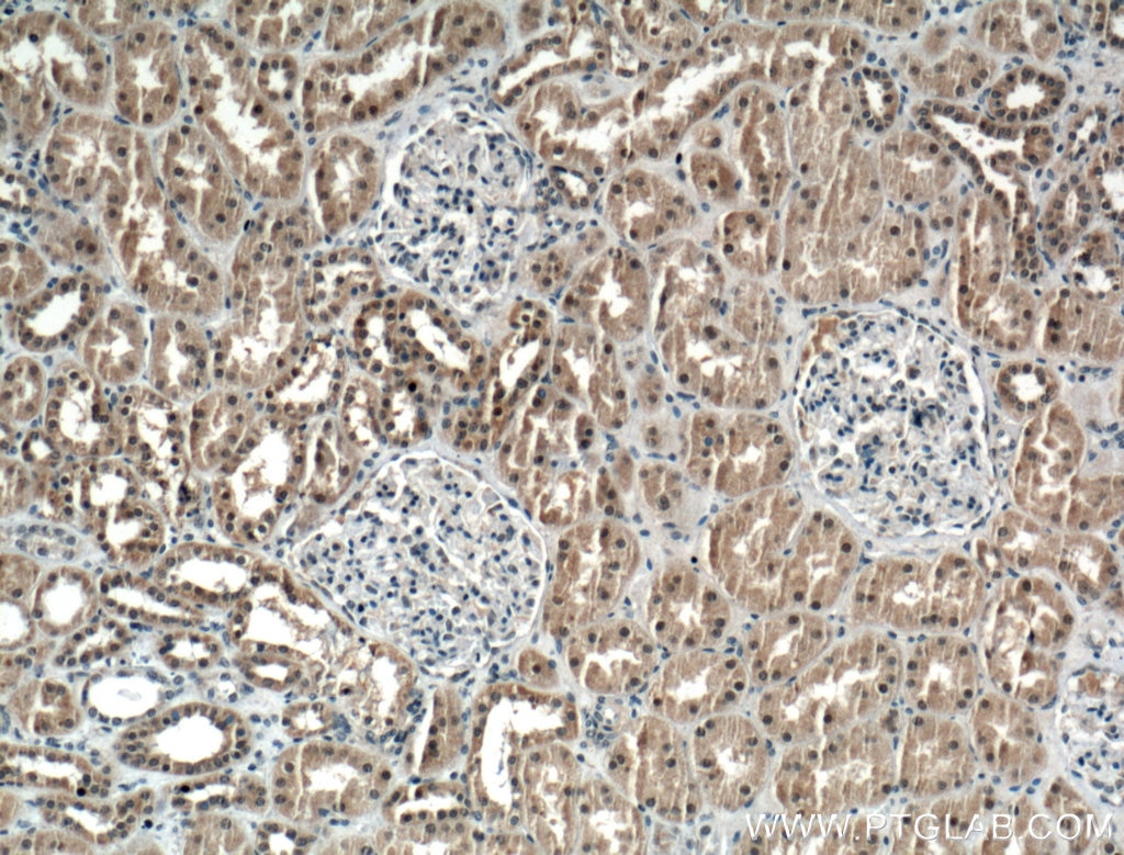 Immunohistochemistry (IHC) staining of human kidney tissue using LSM8 Polyclonal antibody (10134-1-AP)