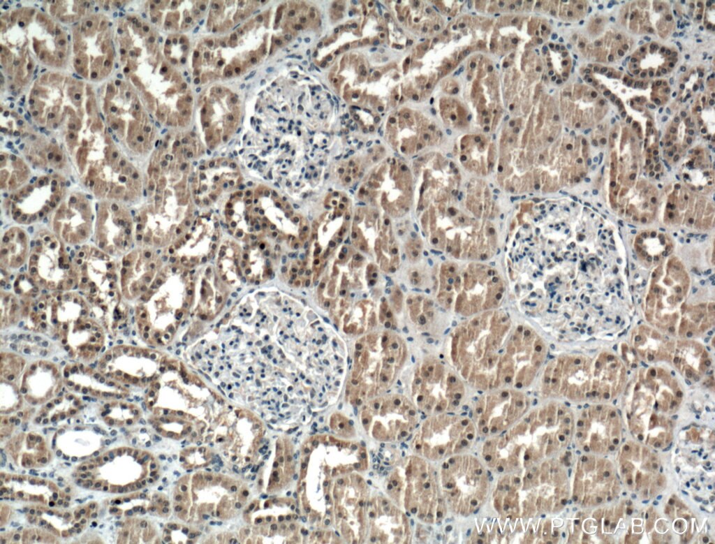 IHC staining of human kidney using 10134-1-AP