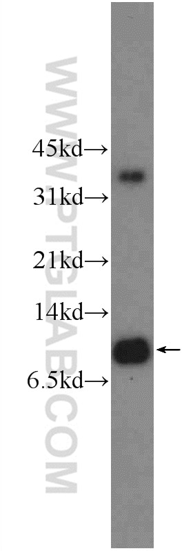 Western Blot (WB) analysis of HeLa cells using LSM8 Polyclonal antibody (10134-1-AP)