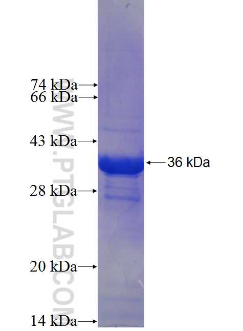 LSM8 fusion protein Ag0178 SDS-PAGE