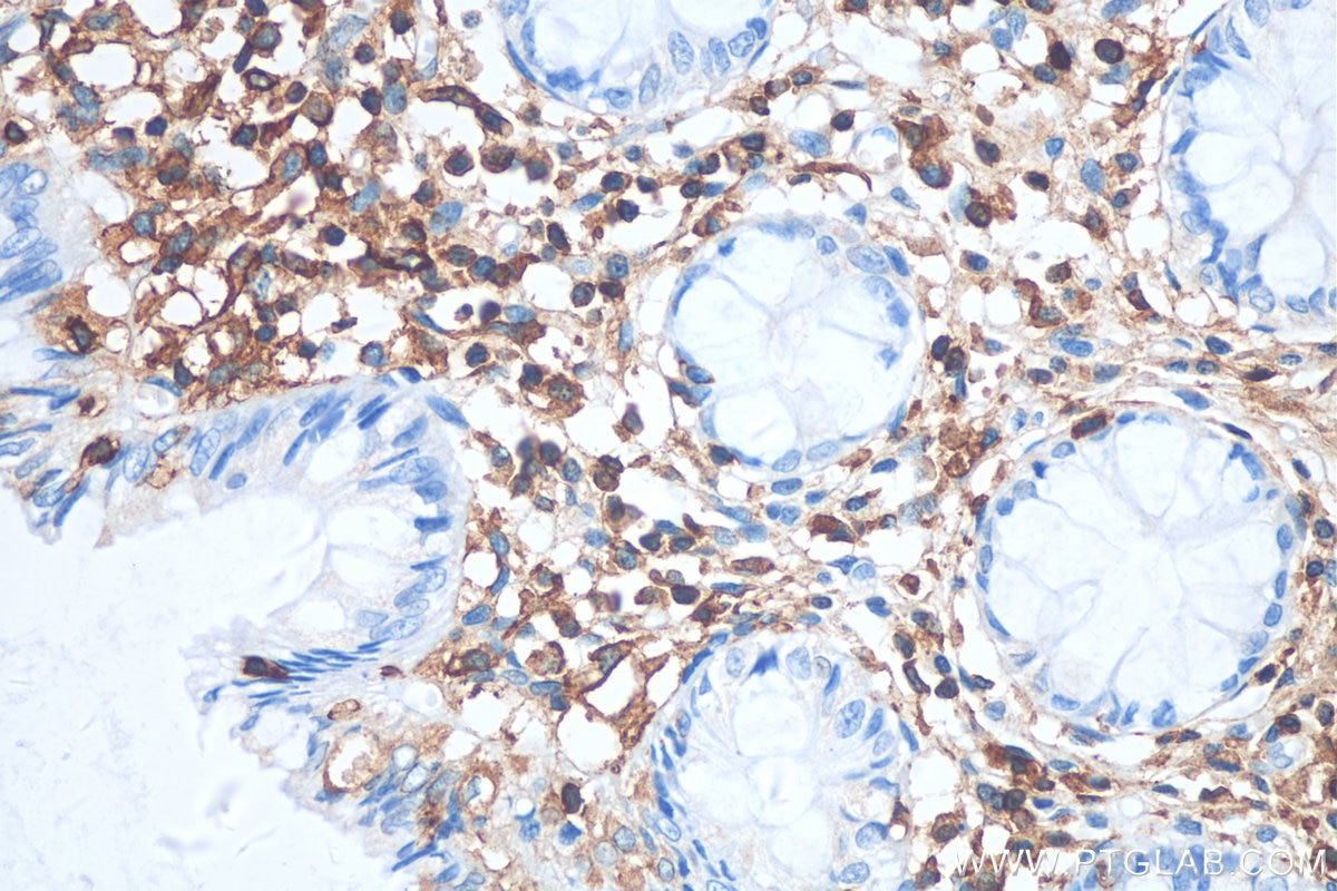 Immunohistochemistry (IHC) staining of human colon tissue using LSP1 Polyclonal antibody (15593-1-AP)