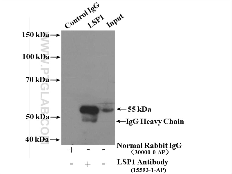 Immunoprecipitation (IP) experiment of Raji cells using LSP1 Polyclonal antibody (15593-1-AP)